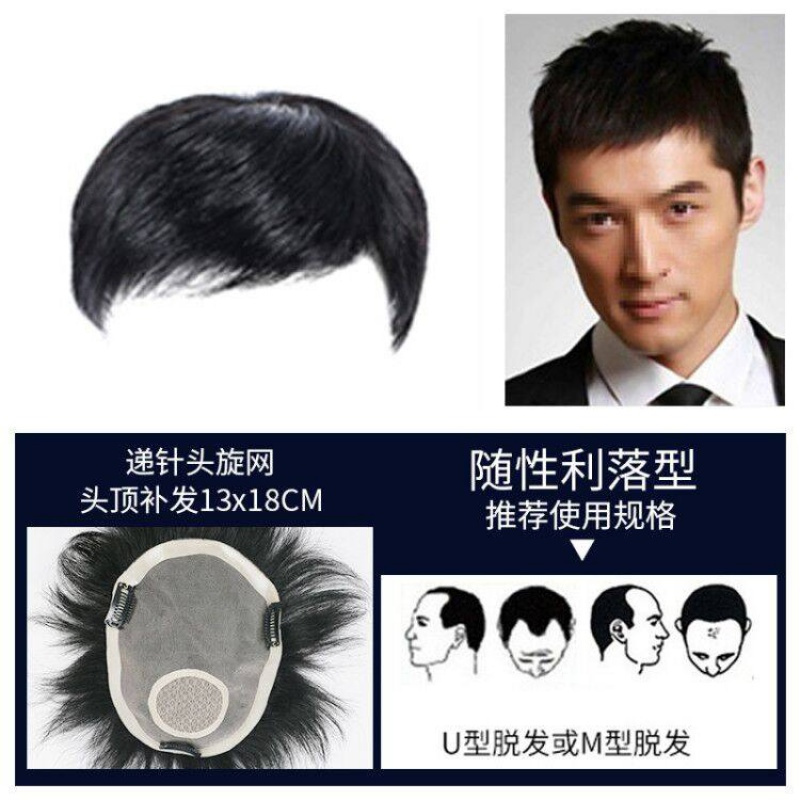 采药师caiyaoshi假发男真人发丝男士假发男短发头顶补发片真人发丝