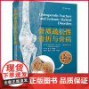 正版 骨质疏松性骨折与骨病 高桥荣明 大卫·B.伯尔等 著 中国科学技术出版社 9787523604533