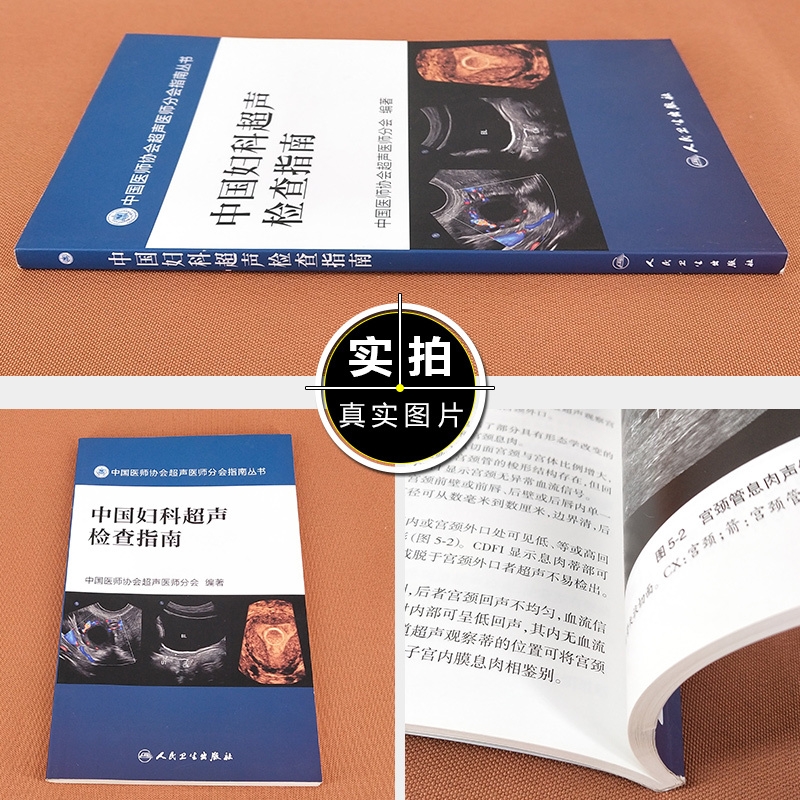 [正版] 中国妇科超声检查指南 中国医师协会超声医师分会指南丛书 妇科临床教程 超声医学参考工具书籍 人民卫生出版社9