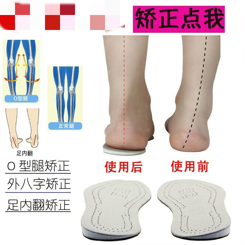 o型腿矫正鞋垫 矫正足内翻外八字脚纠正鞋垫男女通用双面牛皮