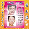 高清女士面部面痣图点痣写真海报挂图除痣消痣取痣祛痣面相挂画 30.40cm偏小 PP胶(撕开即贴)
