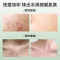 北京同仁堂草本植萃祛痘膏去学生青春痘改善油痘肌护修保湿女男士通用