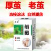 脚底祛老茧专业祛脚茧增厚皮去角质脚垫手脚鸡眼陈年老茧脚皮
