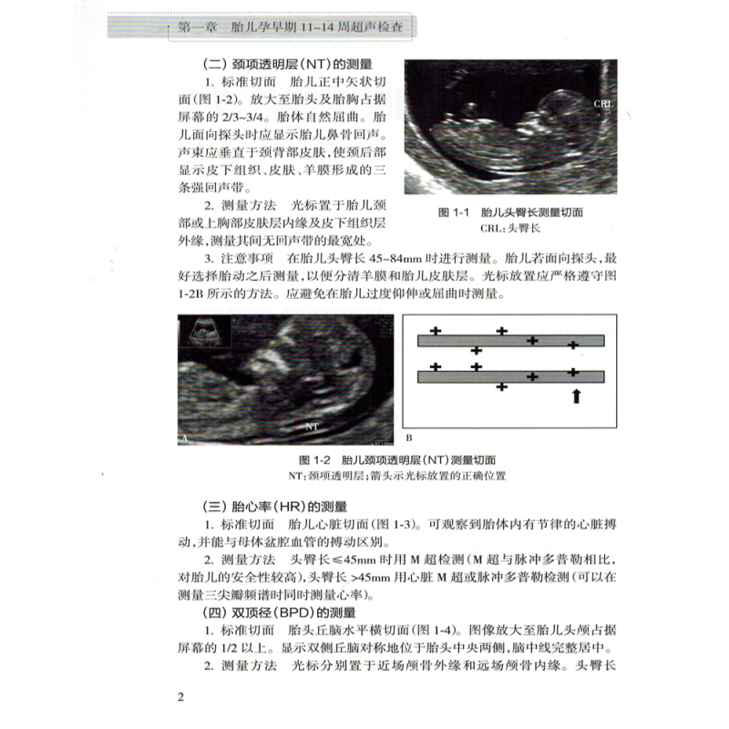 [正版]中国胎儿产前超声检查规范 人卫版 姜玉新主编 中华医学会超声医学分会编著 西医 人民卫生出版社 胎儿产前超声检