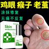 [专业无痛去鸡眼老茧]跖疣脚垫特效去鸡眼贴肉刺手脚抑菌液 1瓶装