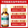 1盒 [轻度灰指甲]送挫刀+黏胶 [同仁堂]灰指甲特效液增厚灰甲亮甲去除灰指甲专用脱甲油抑菌液
