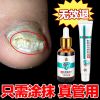 [专克灰甲]灰指甲特效液亮甲去除严重灰指甲脱甲膏抑菌液专用液 灰呷抑菌液[1盒]单购