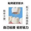 自己动手粘烤瓷牙胶水牙齿钢牙套牙冠假牙专用牙科胶水粘接剂材料 分装六个牙套的量送工具