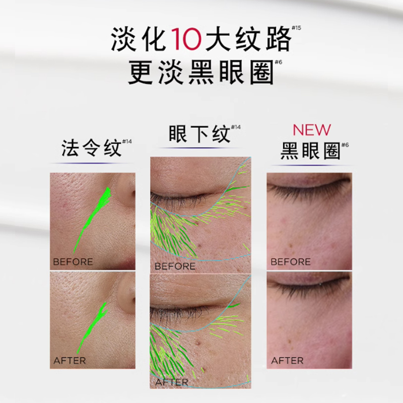 欧莱雅第三代全新升级紫熨斗眼霜保湿抗皱提拉紧致淡化细纹黑眼圈高清大图