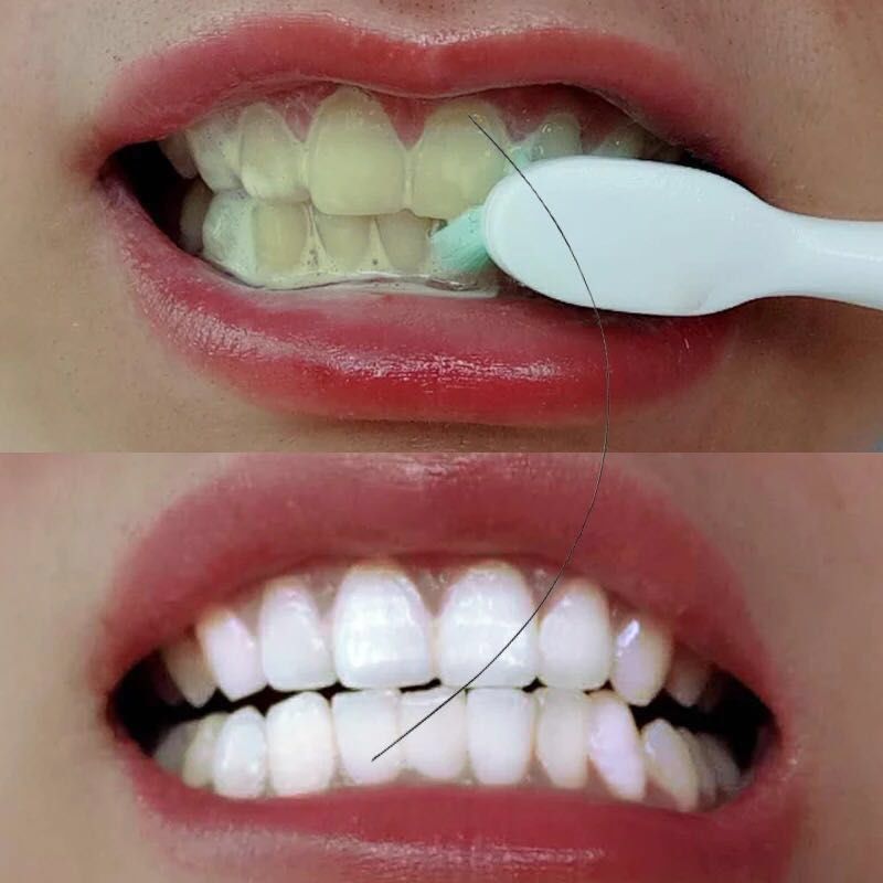 【一刷白】牙齿神器小苏打洗牙粉洁白速效去牙口臭牙斑净