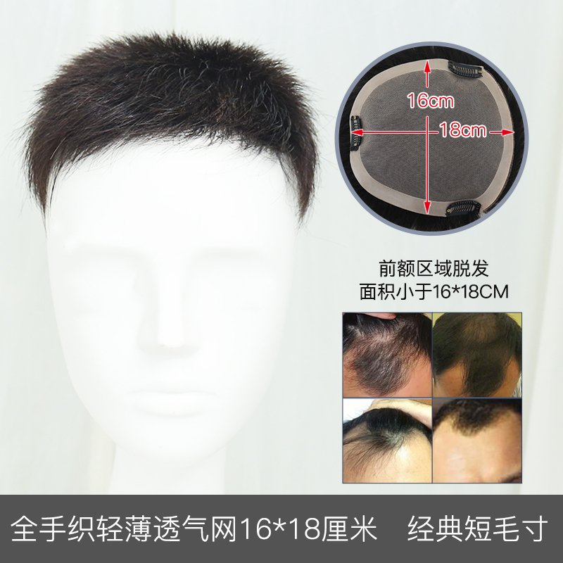 男士假发男短发头顶补发片真人发丝隐形无痕秃顶补发块男士假发片时尚