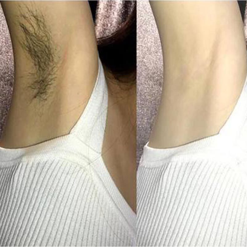 [保密发货]脱毛膏女套装学生腋下男私处脱毛器温和绝毛不永久