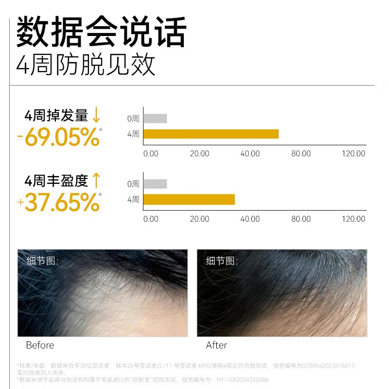 长发小寨固发防脱强韧洗发露400ml高清大图
