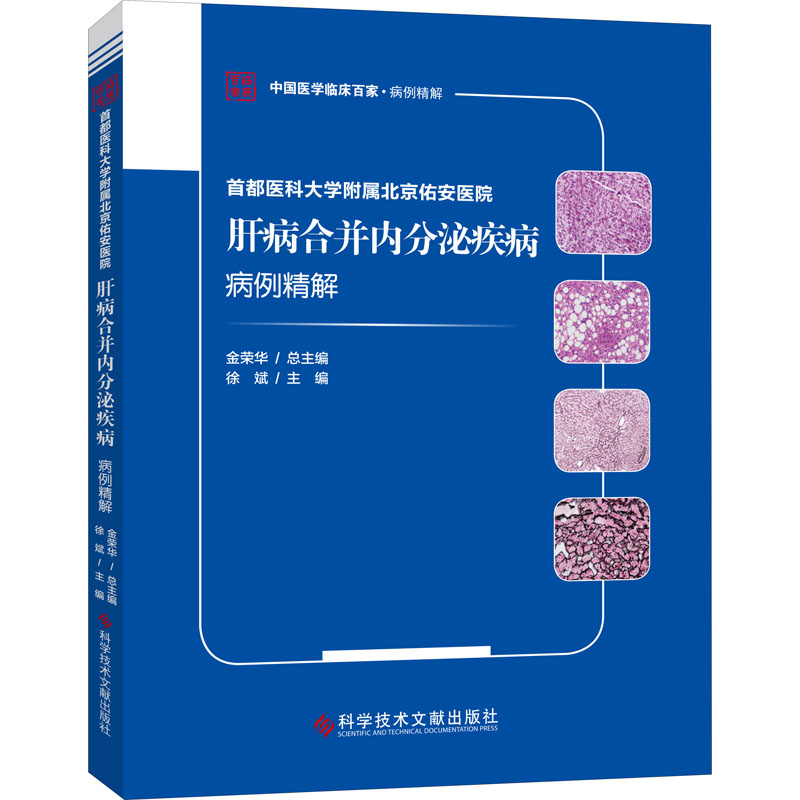 首都医科大学附属北京佑安医院肝病合并内分泌疾病病例精解