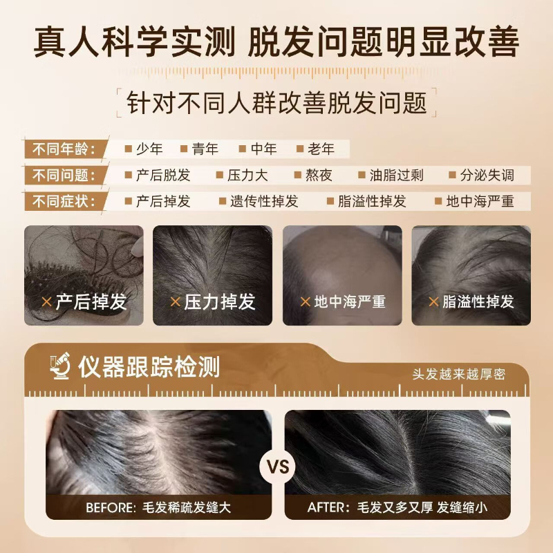 三个魔发匠 强效去屑防脱洗发套装 二硫化硒控油去屑洗发水+防脱精华洗发乳 400ml*2 YGQC高清大图