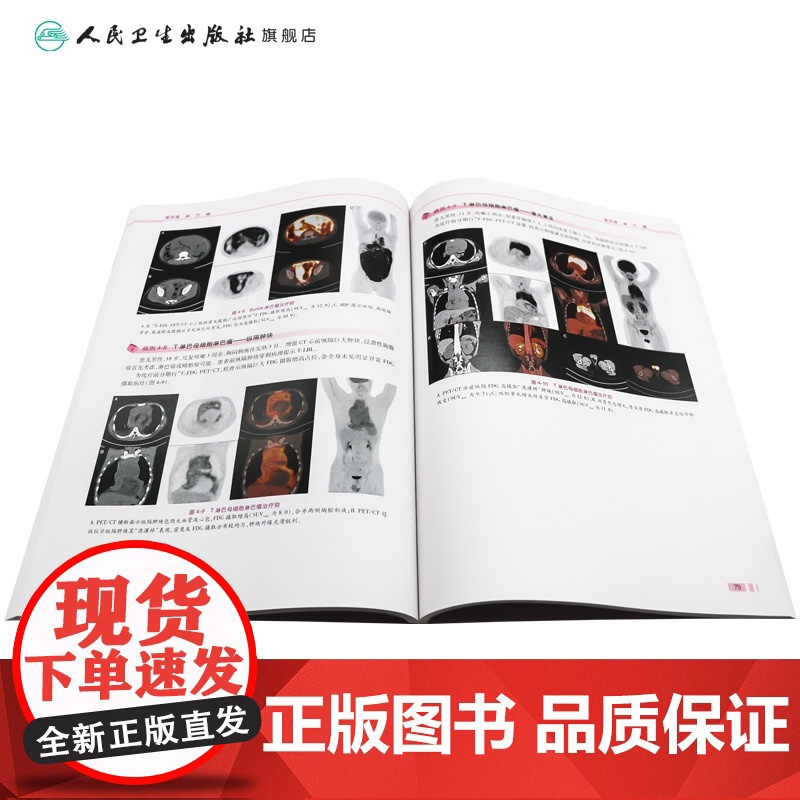 [店] 儿童肿瘤PET/CT图谱 王辉傅宏亮主编 2020年9月参考书高清大图