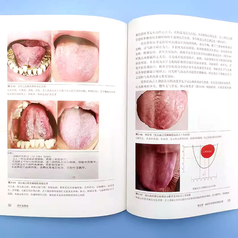 [正版]舌诊全息论 宋维江 附舌诊歌诀 舌诊舌象望诊舌苔中医临床观舌望舌全息 中医学生中医师阅读参考书籍高清大图