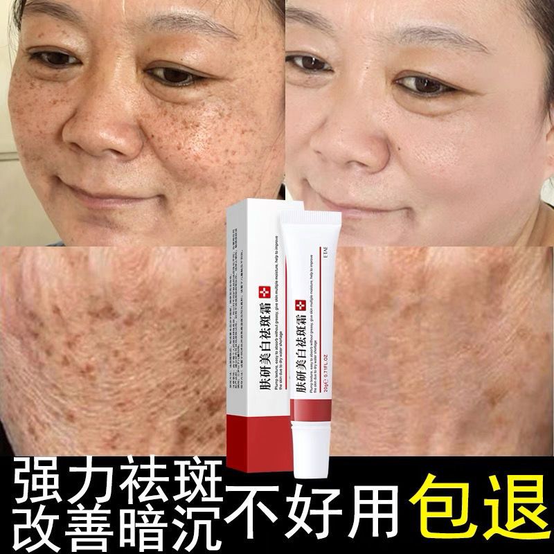 一盒装【小斑点使用】 去班黑斑色斑老年斑男士女专用祛斑霜斑点神器淡化黑色素沉淀脸部