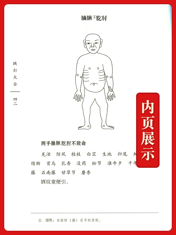 [正版] 跌打大全 清 邱映堂 古籍整理丛书 原文无删减 基础入门书籍临床经验 可搭伤寒论黄帝内经本草纲目神农本草经脉高清大图