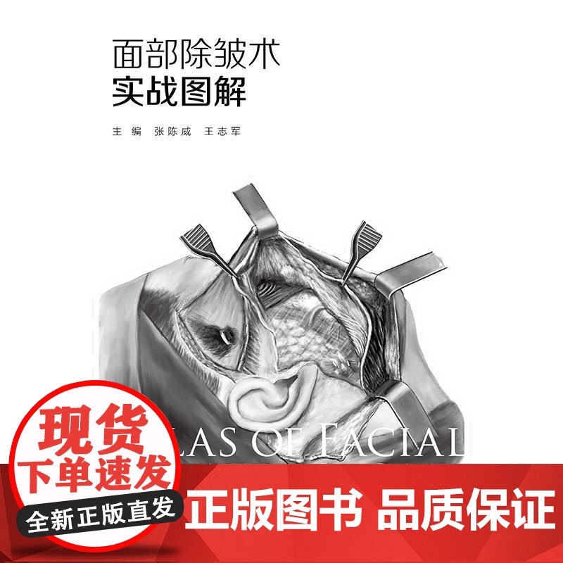 面部除皱术实战图解高清大图