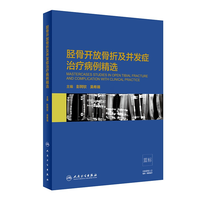 [正版]胫骨开放骨折及并发症治疗病例精选(精) 贾美香,李响,白雅君 医学外科诊断与治疗 外科学基础知识书籍 医学类图书