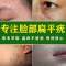 1盒体验装 去除脸部扁平疣丝状疣脖子手脚肉刺瘊子跖疣私处疣腋下身上寻常疣