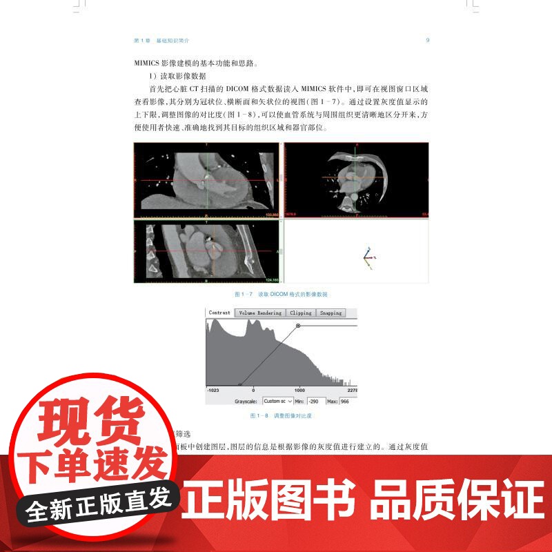 心脑血管植介入器械建模仿真与应用 上海科技出版社计算机建模仿真研究成果高端国产医疗器械发展高清大图