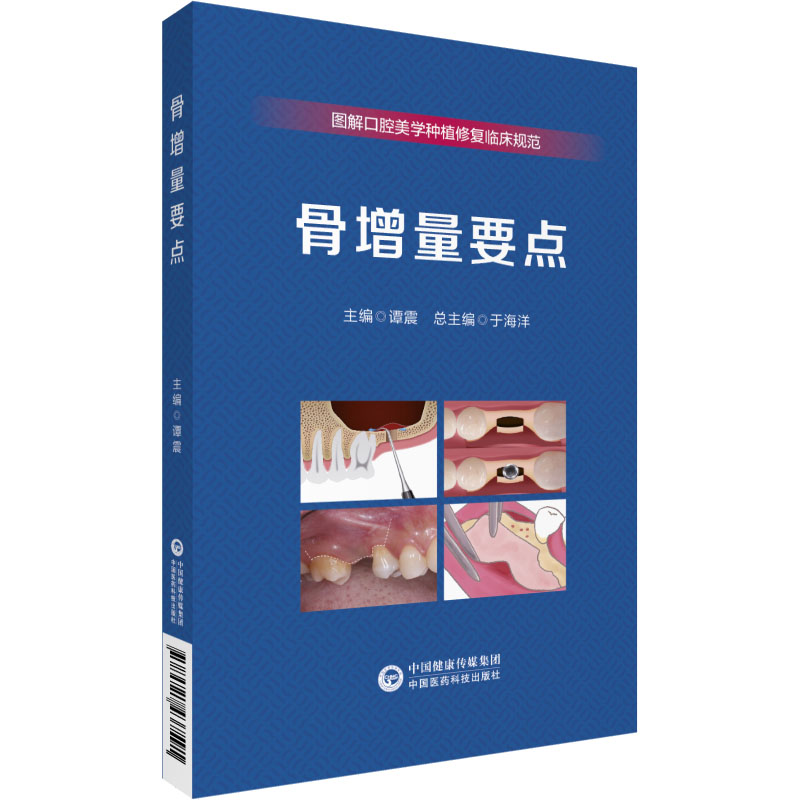 [M]骨增量要点-9787521437591高清大图