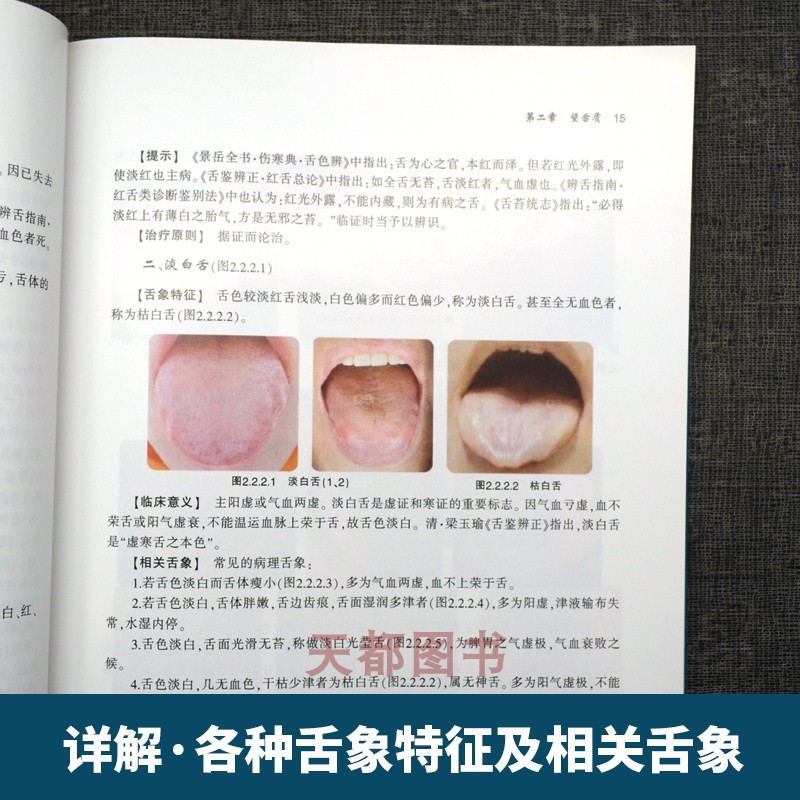[正版]中医舌象辨析 舌诊书图解舌诊断病伸伸舌头把病解入门图谱教程中医养生书籍舌像舌苔辨析临床病症望舌诊病 天津科技翻译