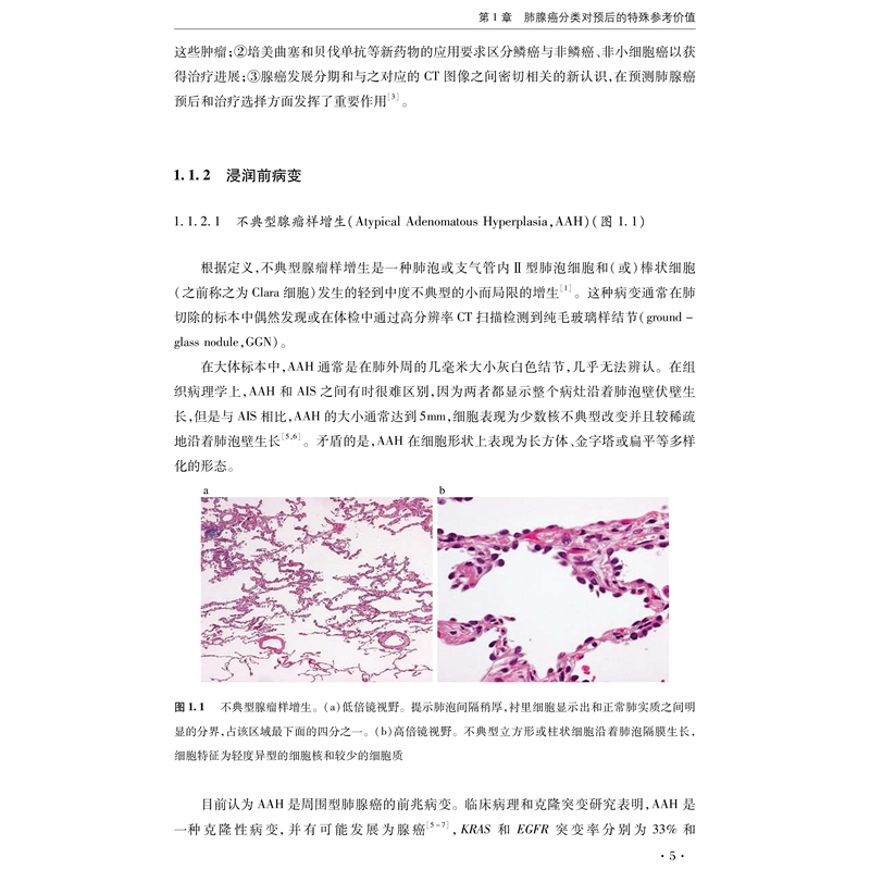 正版新书]肺癌的分子靶向治疗编者:(日)泷口裕一|责编:马凌飞//高清大图