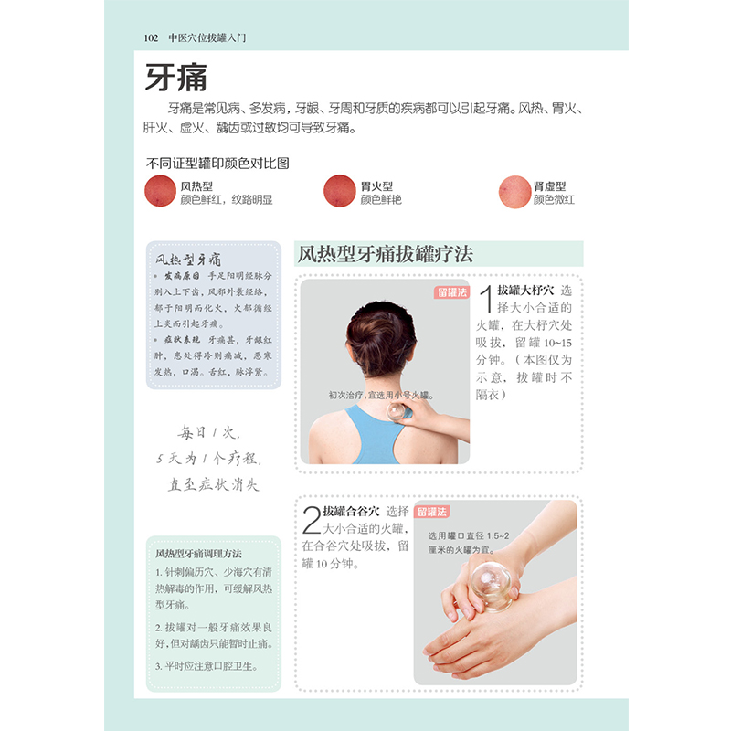 [醉染正版]中医穴位拔罐入门 刮痧拔罐经络养生书拔罐书籍中医穴位图解书中医经络穴位书籍中医养生书籍中医推拿按摩书中医穴位高清大图