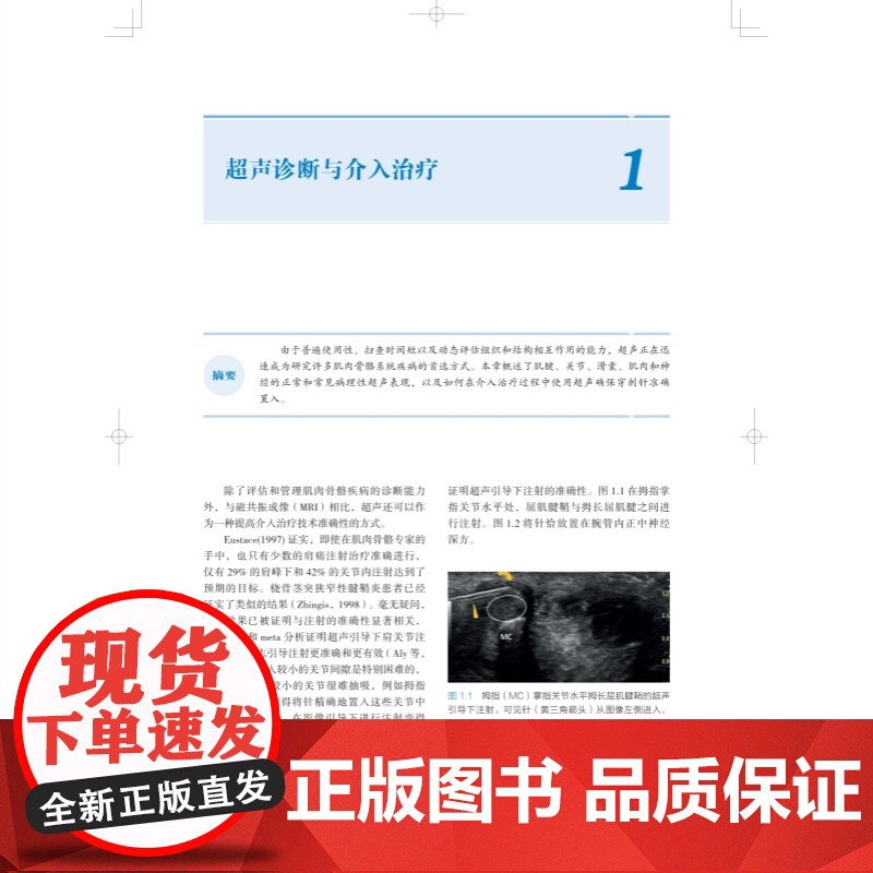 肌肉骨骼超声诊断与介入治疗实用指南 临床医生超声操作指南上海科学技术出版社临床医学外科学肌肉骨骼介入运动医学关节外科高清大图