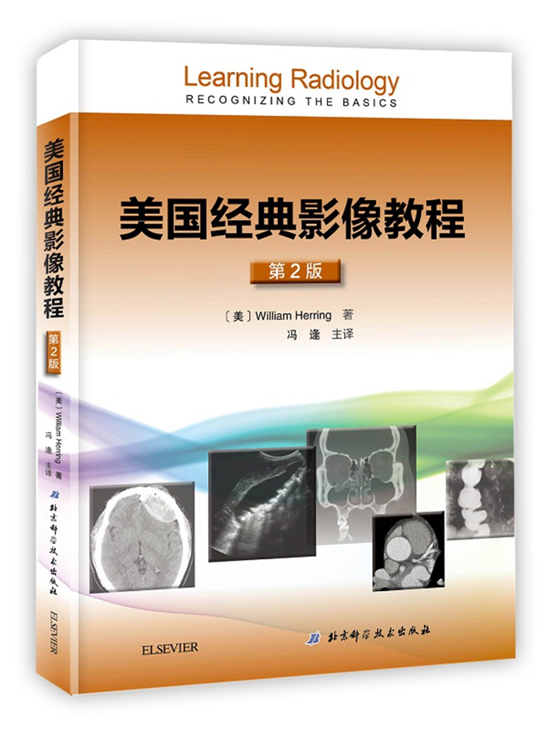 超声解剖及扫查技巧图解高清大图