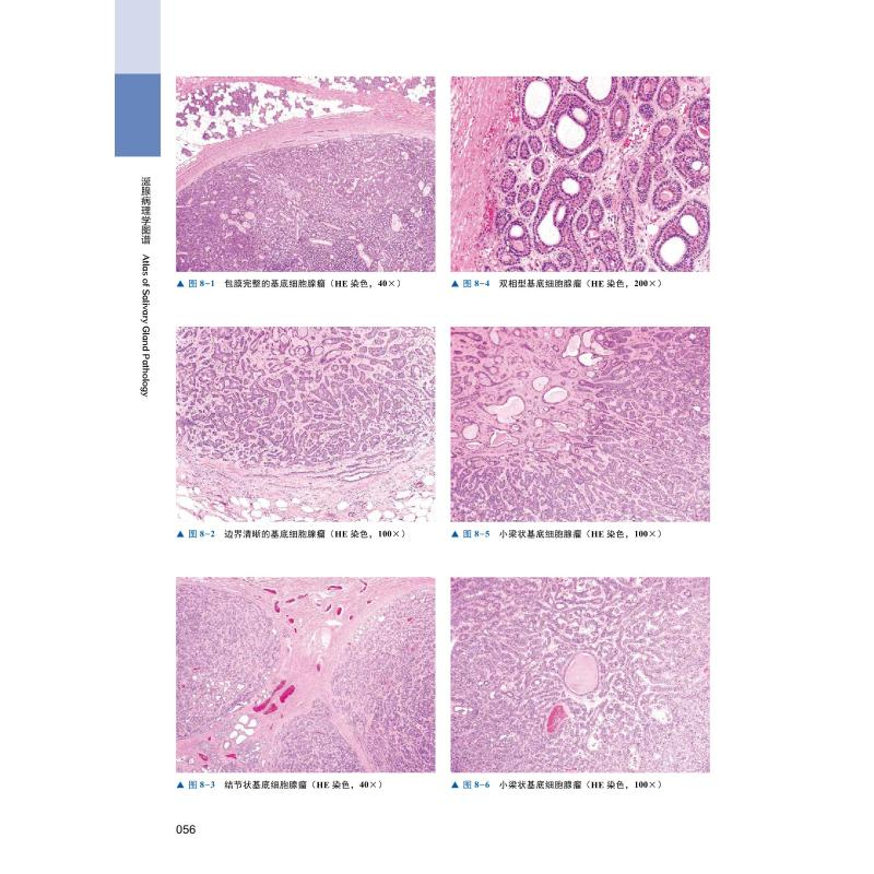 醉染图书涎腺病理学图谱9787504689979高清大图