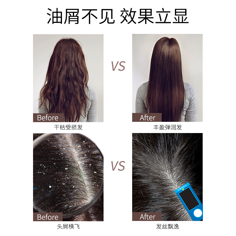 汇仁仁和滋养去屑洗发水 防脱洗发水生姜精华修护强韧控油滋养头皮洗发膏官方正品
