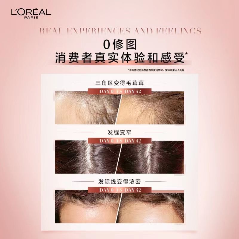 欧莱雅防脱小水枪喷雾固发护发头皮护理强韧发根精华液90ml