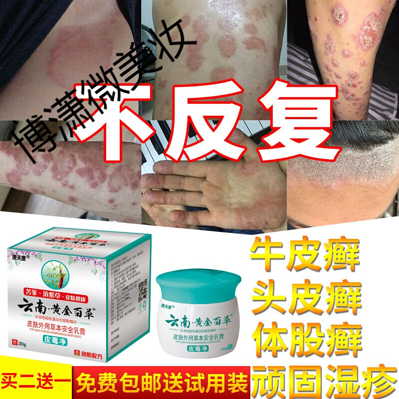 蓝尼芳可 Lnfk 润体霜本维莫德乳膏鲜银屑手足股藓湿s疹止痒去根断根皮肤专用外用真菌感染y膏 价格图片品牌报价 苏宁易购创达豪美妆专营店