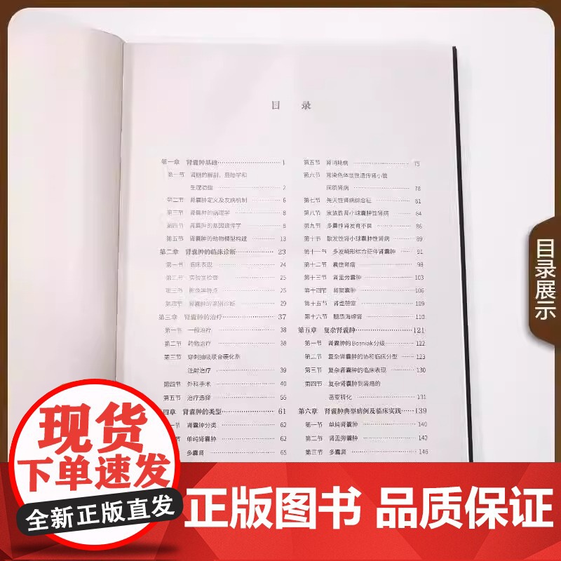 协和肾囊肿外科学 董德鑫 张玉石 肾囊肿流行病学 诊断方法 外科治疗技术书籍中国协和医科大学出版社97875679242高清大图