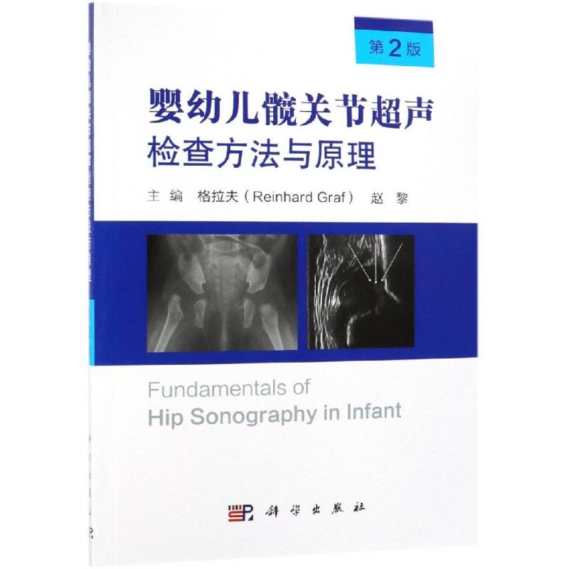 【M】婴幼儿髋关节超声检查方法与原理(第2版)-9787030607805