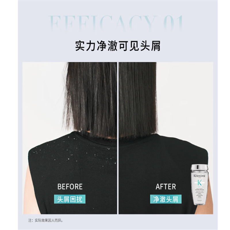 卡诗 全新自在瓶洗发水250ml去屑控油止痒清爽维稳深层清洁高清大图