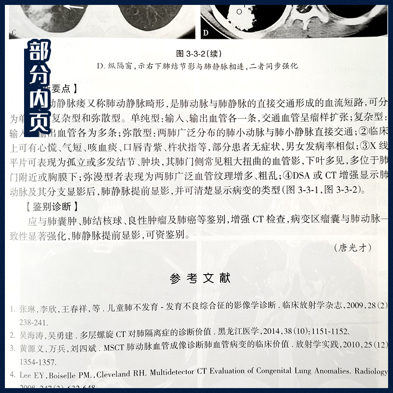 [正版]全套4本医学影像学读片诊断图谱胸部头颈腹部骨肌全4册放射医学诊断参考书X光CT MRI影像诊断指南初学教 胸部高清大图