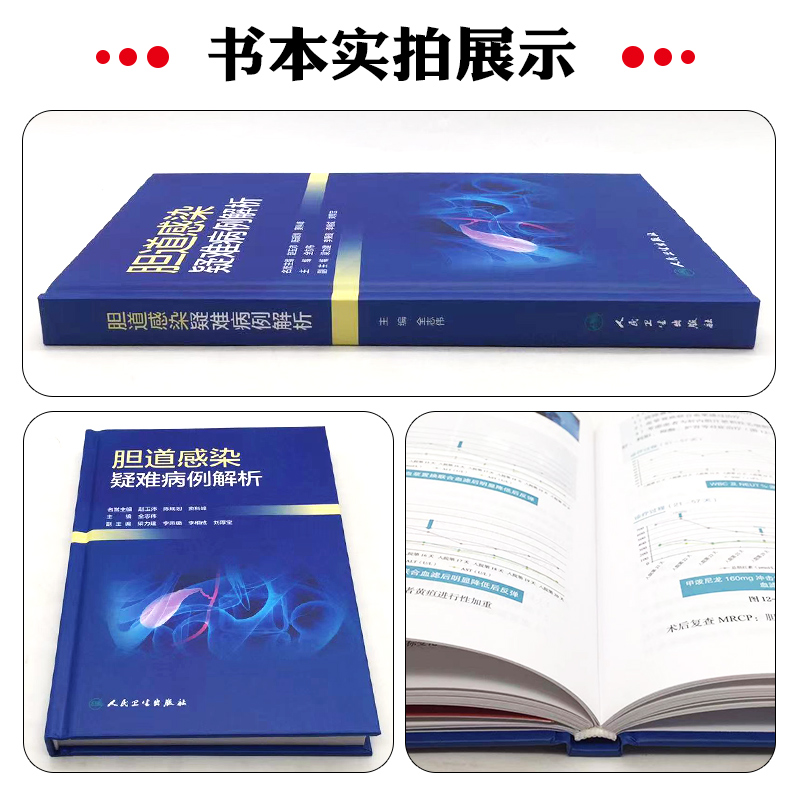 [正版]胆道感染疑难病例解析 人民卫生出版社9787117341165高清大图
