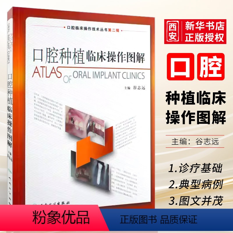 [正版]口腔种植临床操作图解 人民卫生出版社 谷志远 拔牙技巧学义齿全瓷修复颌面外科正畸黏膜病学牙髓之路 口腔医学书籍