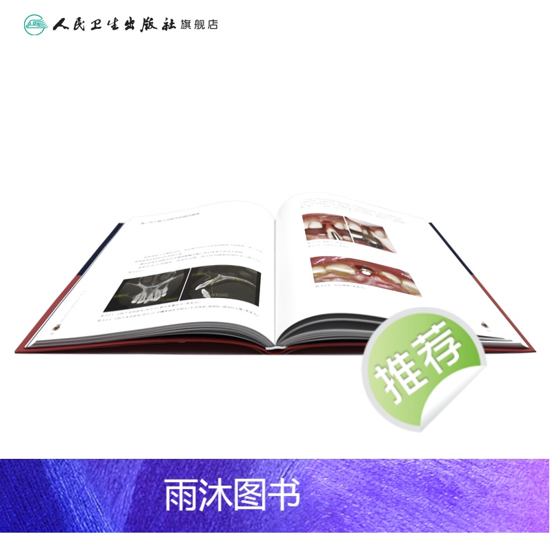 [正版]口腔种植的精准植入技巧满毅搭口腔种植的精准二期手术和取模技巧手术学图解前后牙全口义齿拔牙假牙修复主治医师口腔种高清大图