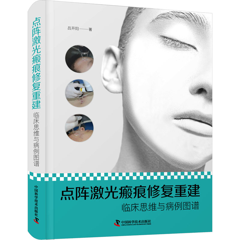 【M】点阵激光瘢痕修复重建 临床思维与病例图谱-9787504696755