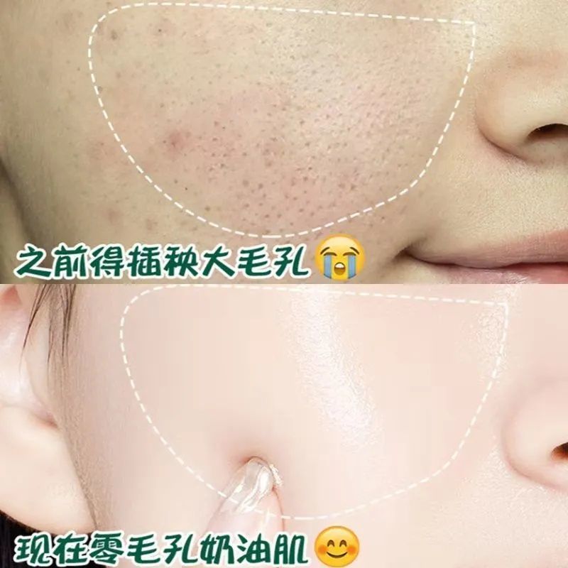 单瓶体验装 收缩毛孔去黑头去痘印去角质粉刺毛孔粗大修复精华液补水男女学生