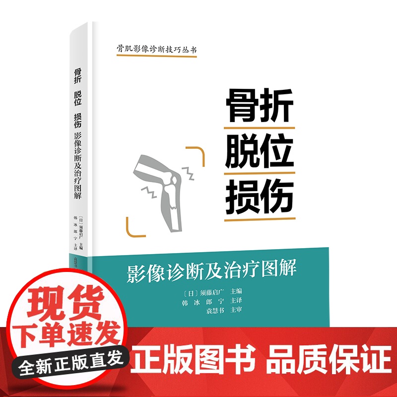 骨折 脱位 损伤:影像诊断及治疗图解 详细分型 高清图片 视频演示 北京科学技术高清大图