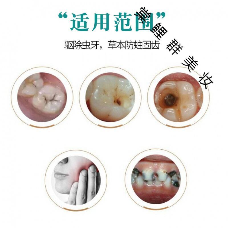 蛀牙杀虫蛀牙修复牙洞清理牙齿黑斑防儿童龋齿去杀蛀虫除虫牙黑牙膏