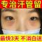 [不消白送]汗管留去除神器去脂肪粒汗管粒油脂粒祛眼部颗粒眼霜