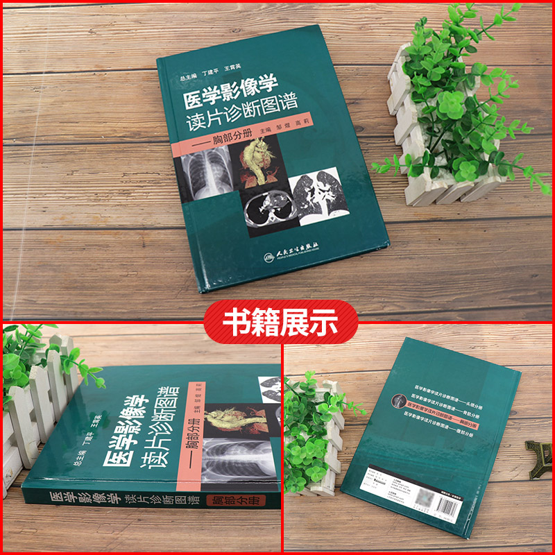 [正版]医学影像学读片诊断图谱胸部分册 头颈胸腹骨肌部放射医学超声诊断学影像解剖学胸部影像学x线读片指南磁共振ct诊断高清大图